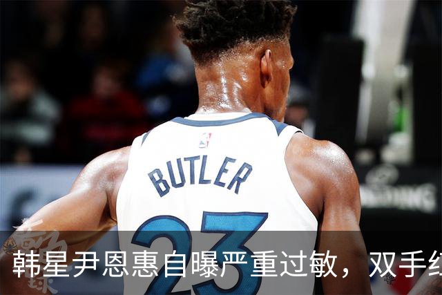 韩星尹恩惠自曝严重过敏，双手红肿蔓延至全脸，痒到整宿睡不着觉
